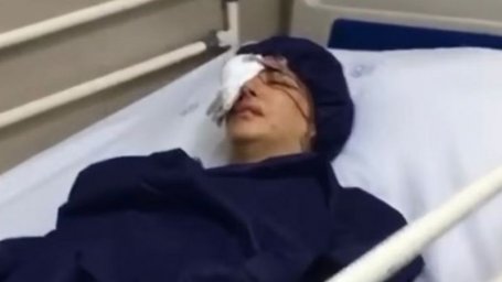 Многие демонстранты в Иране получили ранения глаз. Они уверены, что силовики это делали намеренно